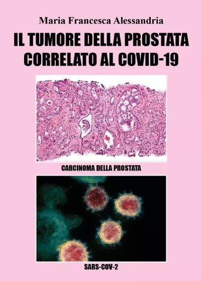 Il tumore alla prostata correlato al Covid-19 di?Maria Francesca Alessandria,?? libro usato