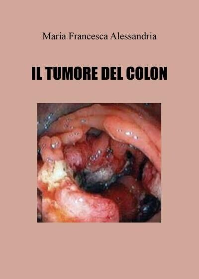 Il tumore del colon di Maria Francesca Alessandria, 2022, Youcanprint libro usato