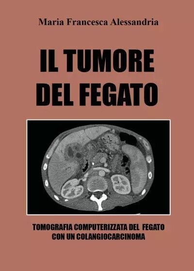 Il tumore del fegato di Maria Francesca Alessandria, 2022, Youcanprint libro usato