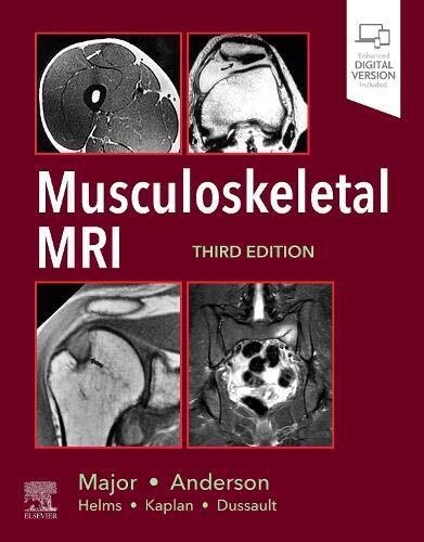 Musculoskeletal MRI - M. Anderson, N. Major - Elsevier, 2019 libro usato