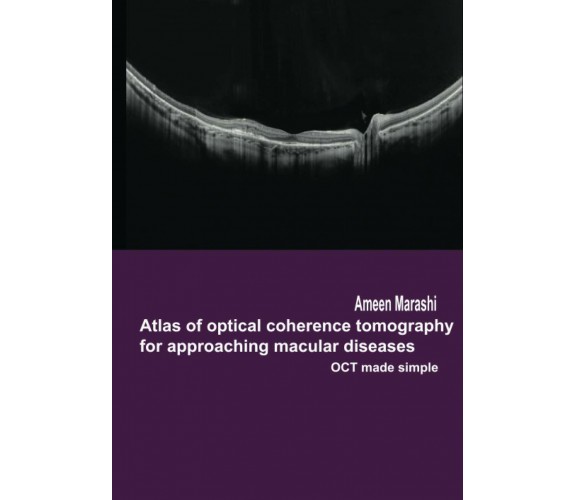 Atlas of Optical Coherence Tomography for Approaching Macular Diseases OCT Made 