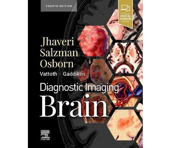 Brain - Miral D. Jhaveri - Elsevier, 2020