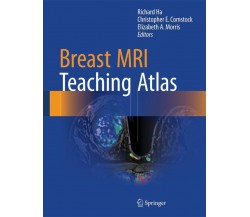 Breast MRI Teaching Atlas -  Richard Ha - Spinger, 2016