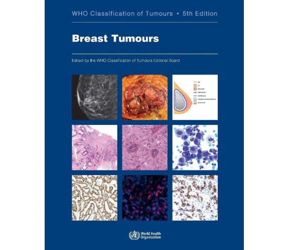 Breast Tumours - Who Classification of Tumours Editorial Board - 2019