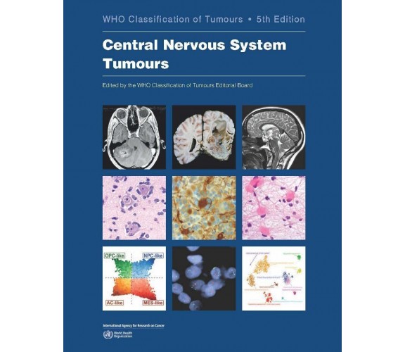 Central Nervous System Tumours - World Health Organization - 