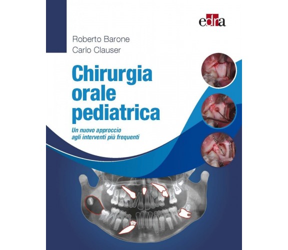 Chirurgia orale pediatrica - Roberto Barone, Carlo Clauser - Edra, 2022