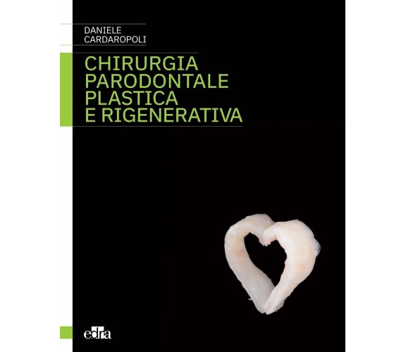 Chirurgia parodontale plastica e rigenerativa - Daniele Cardaropoli - Edra, 2021