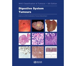 Digestive System Tumours - Who - WORLD HEALTH ORGN, 2019