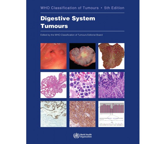 Digestive System Tumours - Who - WORLD HEALTH ORGN, 2019