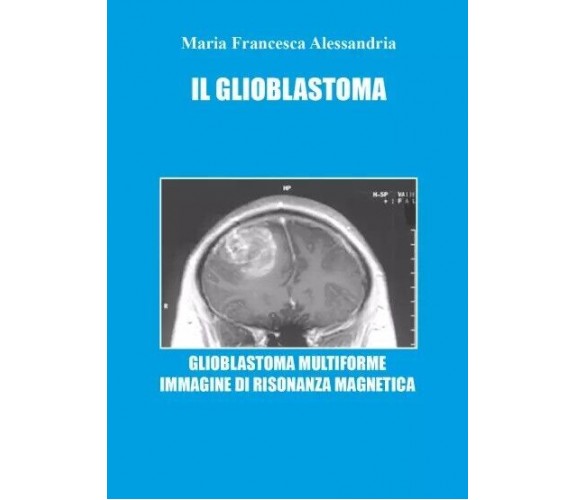 Il Glioblastoma di Maria Francesca Alessandria, 2023, Youcanprint