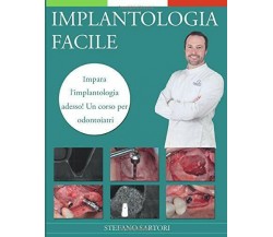 Implantologia Facile Impara l’implantologia Adesso! un Corso per Odontoiatri di 