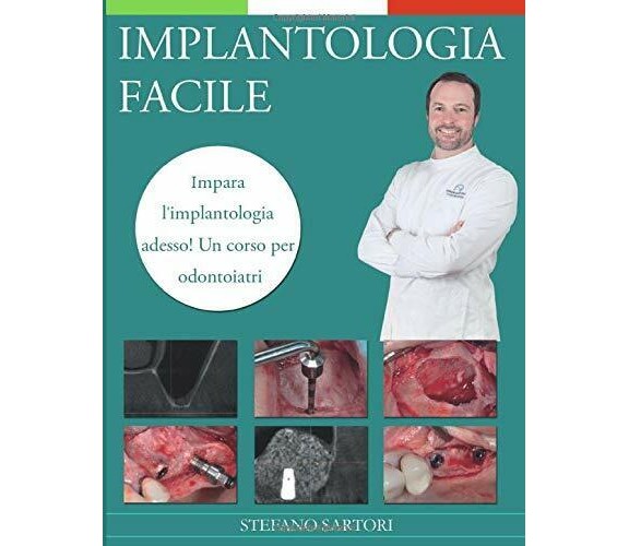 Implantologia Facile Impara l’implantologia Adesso! un Corso per Odontoiatri di 