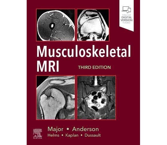 Musculoskeletal MRI - M. Anderson, N. Major - Elsevier, 2019