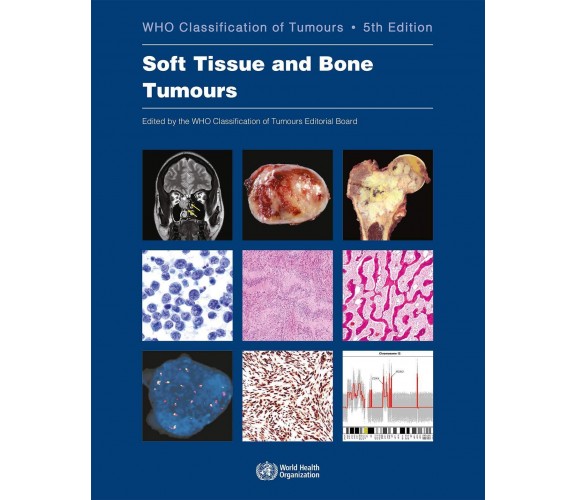 Soft Tissue and Bone Tumours - Who Classification of Tumours Editorial - 2020