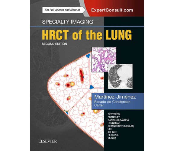 Specialty Imaging: HRCT of the Lung - Elsevier, 2017